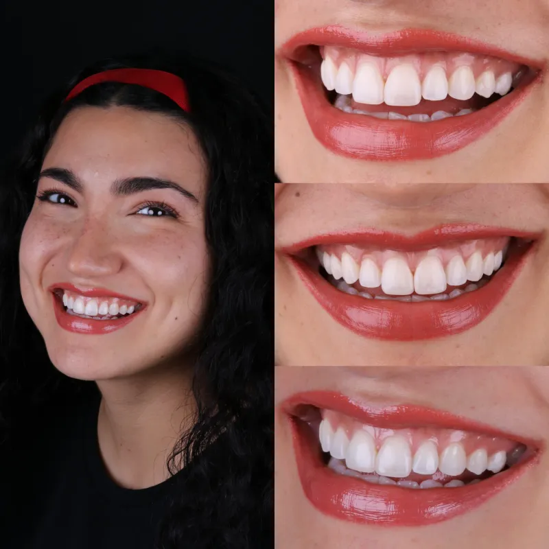 Rehabilitación Estética